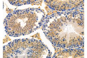 ABIN6259873 and ABIN6273990 at 1/100 staining Mouse testis tissue by IHC-P. (ALAS1 抗体  (Internal Region))