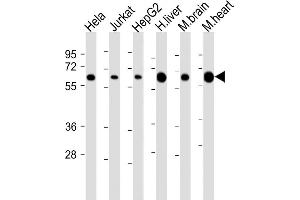 All lanes : Anti-PGM1 Antibody (Center) at 1:2000 dilution Lane 1: Hela whole cell lysate Lane 2: Jurkat whole cell lysate Lane 3: HepG2 whole cell lysate Lane 4: human liver lysate Lane 5: mouse brain lysate Lane 6: mouse heart lysate Lysates/proteins at 20 μg per lane. (Phosphoglucomutase 1 抗体  (AA 251-282))
