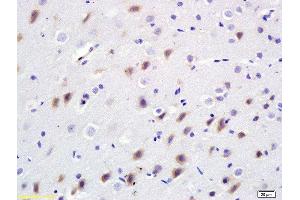 Formalin-fixed and paraffin embedded rat brain labeled with Anti-Bdkrb2/B2R Polyclonal Antibody, Unconjugated  at 1:200 followed by conjugation to the secondary antibody and DAB staining. (BDKRB2 抗体  (AA 51-150))