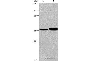 Western blot analysis of Human testis tissue and transitional cell carcinoma of bladder tissue, using FUT1 Polyclonal Antibody at dilution of 1:250 (FUT1 抗体)
