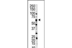 Western blot analysis of anti-NLK Pab in A375 cell lysate (Nemo-Like Kinase 抗体  (C-Term))