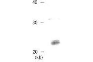 Western Blotting (WB) image for anti-Chromobox Homolog 3 (CBX3) (C-Term) antibody (ABIN2452035) (CBX3 抗体  (C-Term))