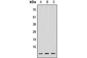 Western blot analysis of NDUFV3 expression in HeLa (A), Raw264. (NDUFV3 抗体  (Center))