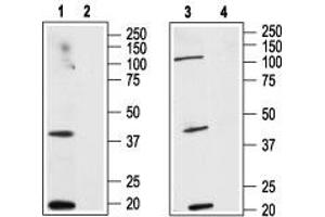 Western blot analysis of human HL-60 acute promyelocytic leukemia cell line lysate (lanes 1 and 2) and human MCF-7 breast adenocarcinoma cell line lysate (lanes 3 and 4):  - 1,3. (CNR2 抗体  (Extracellular, N-Term))