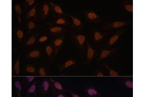 Immunofluorescence analysis of U-2 OS cells using FCF1 Polyclonal Antibody at dilution of 1:100. (FCF1 抗体)