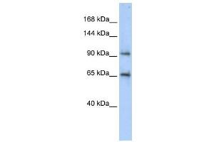 CCDC52 antibody used at 1 ug/ml to detect target protein. (SPICE1 抗体  (Middle Region))