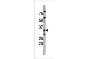 The anti-Phospho-Cdk2- Pab (ABIN389540 and ABIN2839586) is used in Western blot to detect Phospho-Cdk2- in  tissue lysate (CDK2 抗体  (pThr160))