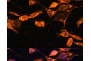 Immunofluorescence analysis of NIH-3T3 cells using RAB11A Polyclonal Antibody at dilution of 1:100. (RAB11A 抗体)