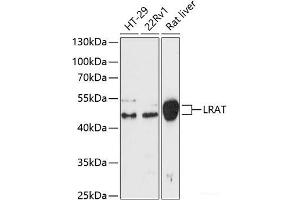 Western blot analysis of extracts of various cell lines using LRat Polyclonal Antibody at dilution of 1:3000. (LRAT 抗体)