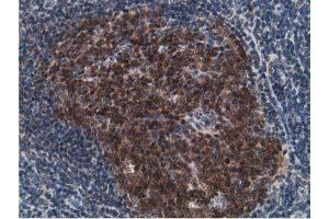 Image no. 2 for anti-Deoxycytidine Kinase (DCK) antibody (ABIN1497773) (DCK 抗体)