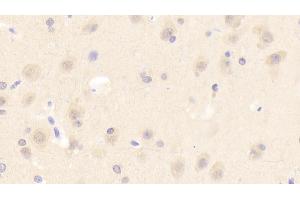 Detection of ASM in Human Cerebrum Tissue using Polyclonal Antibody to Acid Sphingomyelinase (ASM) (SMPD1 抗体  (AA 319-579))