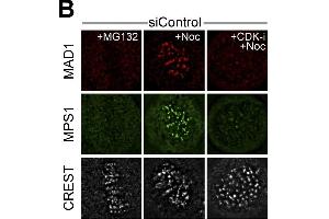 Immunofluorescence (Cultured Cells) (IF (cc)) image for anti-Proteasome (Prosome, Macropain) 26S Subunit, Non-ATPase, 14 (PSMD14) (Center) antibody (ABIN2856031)