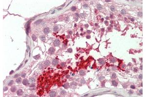 Rabbit Anti-BRDT antibody  Formalin Fixed Paraffin Embedded Tissue: Human Testis Primary antibody Concentration: 1:100 Secondary Antibody: Donkey anti-Rabbit-Cy3 Secondary Antibody Concentration: 1:200 Magnification: 20x Exposure Time: 0. (BRDT 抗体  (N-Term))