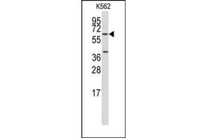 Image no. 1 for anti-Kruppel-Like Factor 4 (Gut) (KLF4) antibody (ABIN357865) (KLF4 抗体)
