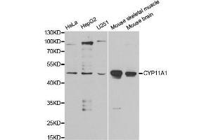 Western blot analysis of extracts of various cell lines, using CYP11A1 antibody. (CYP11A1 抗体  (AA 40-320))