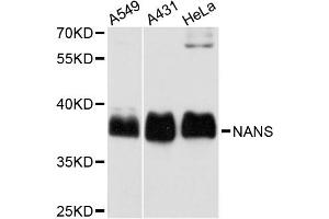 Western blot analysis of extracts of various cell lines, using NANS antibody (ABIN5972748) at 1:3000 dilution. (NANS 抗体)