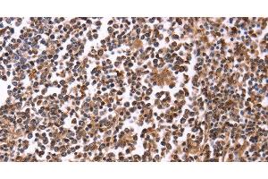 Immunohistochemistry of paraffin-embedded Human tonsil tissue using CRK Polyclonal Antibody at dilution 1:40 (Crk 抗体)