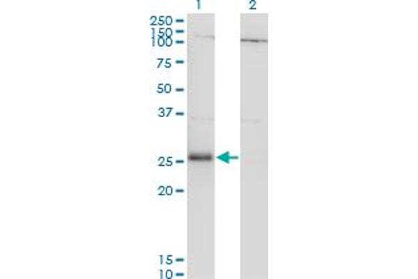 RNF138 抗体  (AA 51-150)