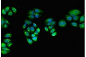 Immunofluorescent analysis of PC-3 cells using ABIN7166589 at dilution of 1:100 and Alexa Fluor 488-congugated AffiniPure Goat Anti-Rabbit IgG(H+L) (PPOX 抗体  (AA 1-477))