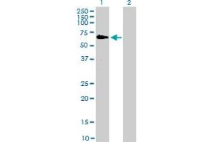 Western Blot analysis of RAF1 expression in transfected 293T cell line by RAF1 monoclonal antibody (M03), clone 1H4. (RAF1 抗体  (AA 1-130))