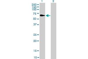 Western Blot analysis of RAF1 expression in transfected 293T cell line by RAF1 monoclonal antibody (M03), clone 1H4. (RAF1 抗体  (AA 1-130))
