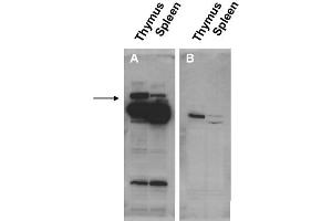 Image no. 1 for anti-Pogo Transposable Element with ZNF Domain (POGZ) (N-Term) antibody (ABIN401435) (POGZ 抗体  (N-Term))