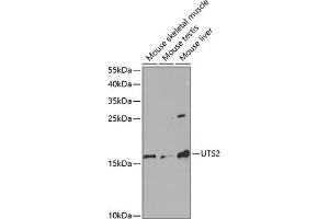 Western blot analysis of extracts of various cell lines, using UTS2 antibody (ABIN6128895, ABIN6150039, ABIN6150040 and ABIN6220965) at 1:1000 dilution. (Urotensin 2 抗体  (AA 35-124))