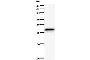 Western Blotting (WB) image for anti-Protein Kinase, CAMP-Dependent, Regulatory, Type I, alpha (Tissue Specific Extinguisher 1) (PRKAR1A) antibody (ABIN931105) (PRKAR1A 抗体)