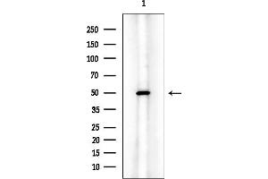 anti-Cleavage and Polyadenylation Factor I Subunit 1 (CLP1) (Internal Region) antibody