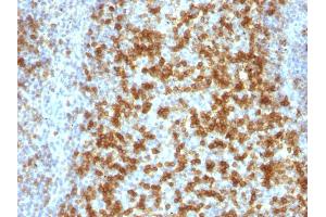 Formalin-fixed, paraffin-embedded human Tonsil stained with PD1 (CD279) Monoclonal Antibody (PDCD1/922). (PD-1 抗体)