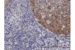 Immunoperoxidase of monoclonal antibody to XCL1 on formalin-fixed paraffin-embedded human tonsil. (XCL1 抗体  (AA 22-114))