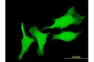 Immunofluorescence (IF) image for anti-Cysteine and Glycine-Rich Protein 3 (CSRP3) (AA 95-194) antibody (ABIN563533)