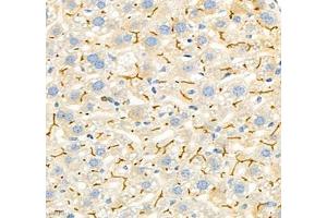 Immunohistochemistry (Paraffin-embedded Sections) (IHC (p)) image for anti-Carcinoembryonic Antigen-Related Cell Adhesion Molecule 1 (CEACAM1) antibody (ABIN7073315)
