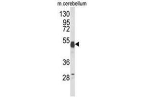 Western blot analysis of UBAP1 Antibody (N-term) in mouse cerebellum tissue lysates (35ug/lane). (UBAP1 抗体  (N-Term))