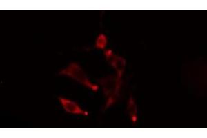 ABIN6275470 staining  LOVO cells by IF/ICC. (Rab5c 抗体  (Internal Region))