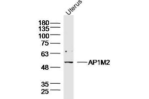 Mouse Uterus lysates probed with AP1M2 Polyclonal Antibody, unconjugated  at 1:300 overnight at 4°C followed by a conjugated secondary antibody for 60 minutes at 37°C. (AP1m2 抗体  (AA 1-100))