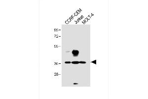 All lanes : Anti-TAL1 Antibody (T90) at 1:1000 dilution Lane 1: CCRF-CEM whole cell lysate Lane 2: Jurkat whole cell lysate Lane 3: MOLT-4 whole cell lysate Lysates/proteins at 20 μg per lane. (TAL1 抗体  (AA 68-97))