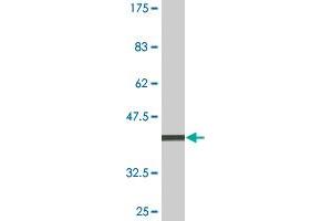 Western Blot detection against Immunogen (36. (LCK 抗体  (AA 1-100))