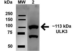 Western blot analysis of Human HeLa cell lysates showing detection of 112. (ULK2 抗体  (AA 558-569) (Atto 488))