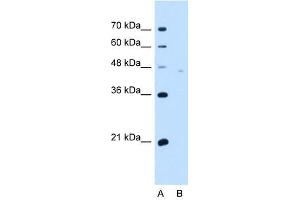 Neuroplastin antibody used at 5 ug/ml to detect target protein. (NPTN 抗体  (Middle Region))