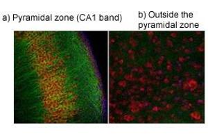 Immunohistochemistry (IHC) image for anti-Transient Receptor Potential Cation Channel, Subfamily V, Member 4 (TRPV4) (Middle Region) antibody (ABIN2776284)