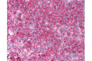 Anti-CD82 antibody IHC of human spleen. (CD82 抗体  (C-Term))