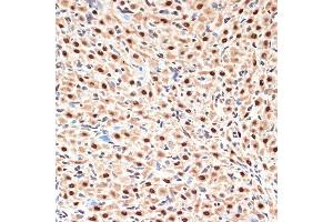 Immunohistochemistry of paraffin-embedded rat ovary using CDC16 Rabbit mAb (ABIN1678585, ABIN3017837, ABIN3017838 and ABIN7101525) at dilution of 1:100 (40x lens). (CDC16 抗体)