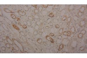 Detection of TF in Human Kidney Tissue using Polyclonal Antibody to Transferrin (TF) (Transferrin 抗体  (AA 361-683))