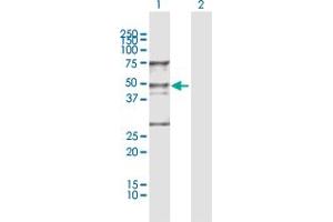 Western Blot analysis of WDR4 expression in transfected 293T cell line by WDR4 MaxPab polyclonal antibody.