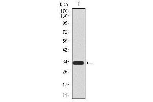 Image no. 2 for anti-HIR Histone Cell Cycle Regulation Defective Homolog A (HIRA) antibody (ABIN1490946) (HIRA 抗体)