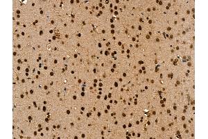 ABIN7094647 and ABIN7098698 at 1/100 staining Rat brain tissue by IHC-P. (ANAPC7 抗体  (C-Term))