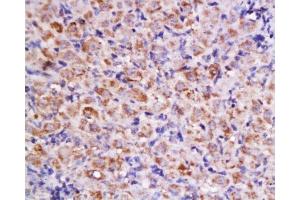 Formalin-fixed and paraffin embedded rat ovary labeled with Anti-Cyclin D2 Polyclonal Antibody, Unconjugated  at 1:200 followed by conjugation to the secondary antibody and DAB staining. (Cyclin D2 抗体  (AA 161-288))