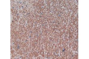 Used in DAB staining on fromalin fixed paraffin- embedded spinal cord tissue (NPR3 抗体  (AA 45-467))