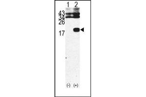 Image no. 1 for anti-beta-2-Microglobulin (B2M) (C-Term) antibody (ABIN357932) (beta-2 Microglobulin 抗体  (C-Term))